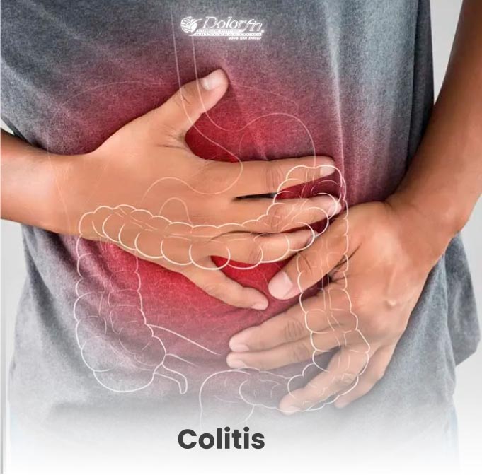 quiropractico-Estado-de-mexico_interlomas_-cita-colitis